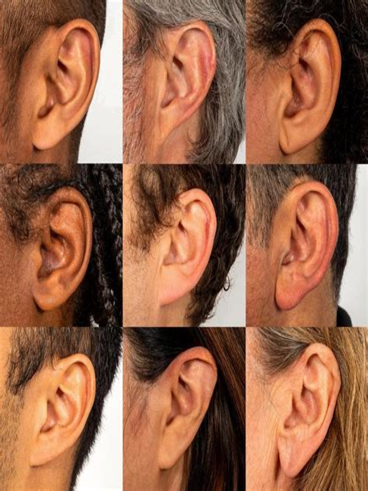 What Ethnicity Has Attached Earlobes? What Percentage Of People Have Attached Earlobes? - Genetics of Earlobes